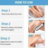 image:imageAngel Kiss Colossal Foot rasp Foot File Callus Remover  Best Foot Care Pedicure Metal Surface Tool to Remove Hard Skin  Can be Used on Both Wet and Dry Feet  Surgical Grade Stainless Steel File