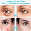 image:imageAngel Kiss Ice Roller for Face Eye  Women Gift Idea  Facial Massage ToolBlue Roller