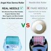 image:imageAngel Kiss Microneedle Derma Roller 192 Individual Stainless Steel Needles