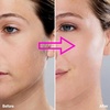 image:imageAngel Kiss Replacement Heads for Flawless Womens Facial Hair Remover Gen 36 PcsPack for Gen 3 New flawless